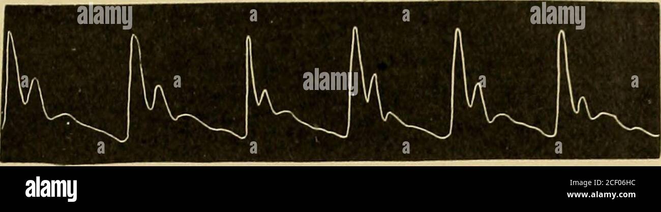 the heart of a woman analysis