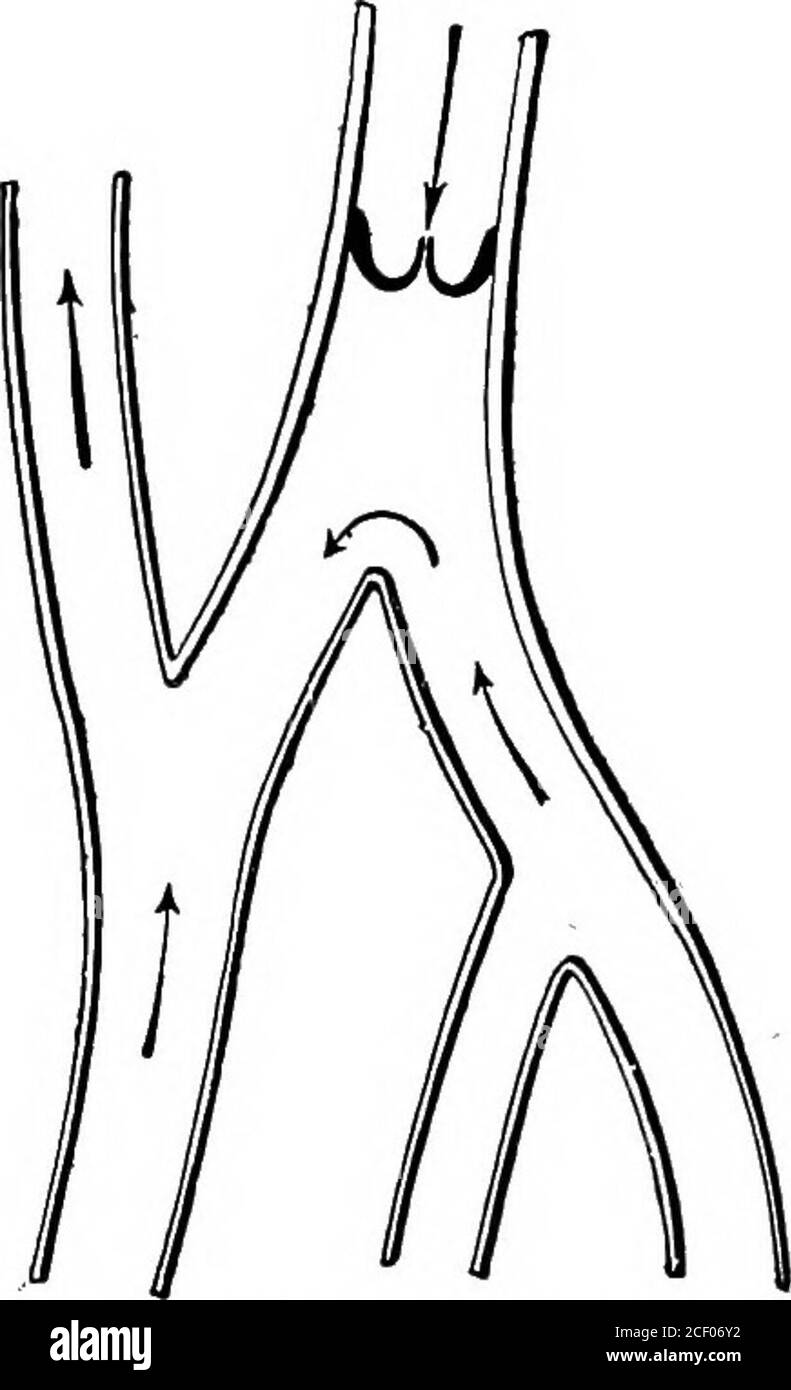 . Human physiology. Fig. 124.—Vein with Valvesopen. Fig. 125.—Vein with Valvea closed;the stream of blood passing off bya lateral branch. arteries, they are capable of conveying to the heart much moreblood in a given time than they receive. Some veins have no valves. Among these may be mentionedthe vena cava, the pulmonary veins, Cos portal vein which suppliesthe liver, the hepatic vein (Gr. hepar, the liver) which takes bloodfrom the liver, and the renal veins (Lat. renes, kidneys) whichlead from the kidneys to the vena cava inferior. Having noticed the chief characters of the different blood Stock Photo