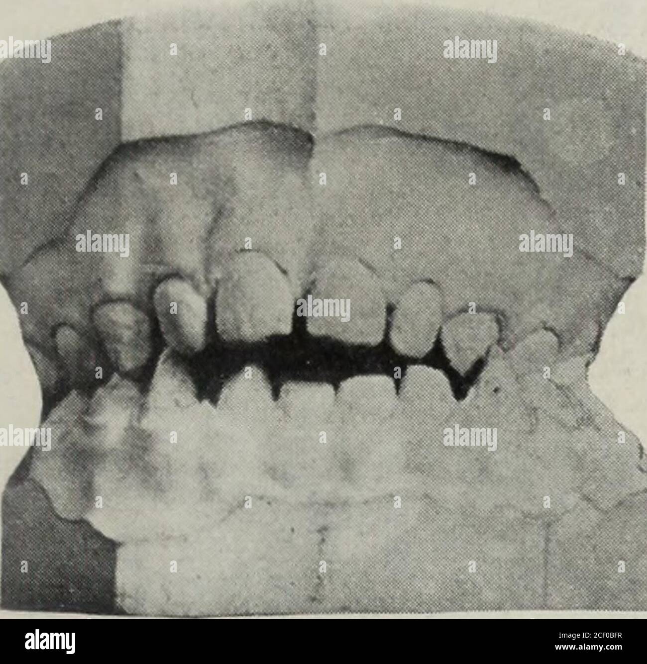 . The Dental cosmos. Drawing of divided arch in same position asFig. 24 ... Biology Diagrams