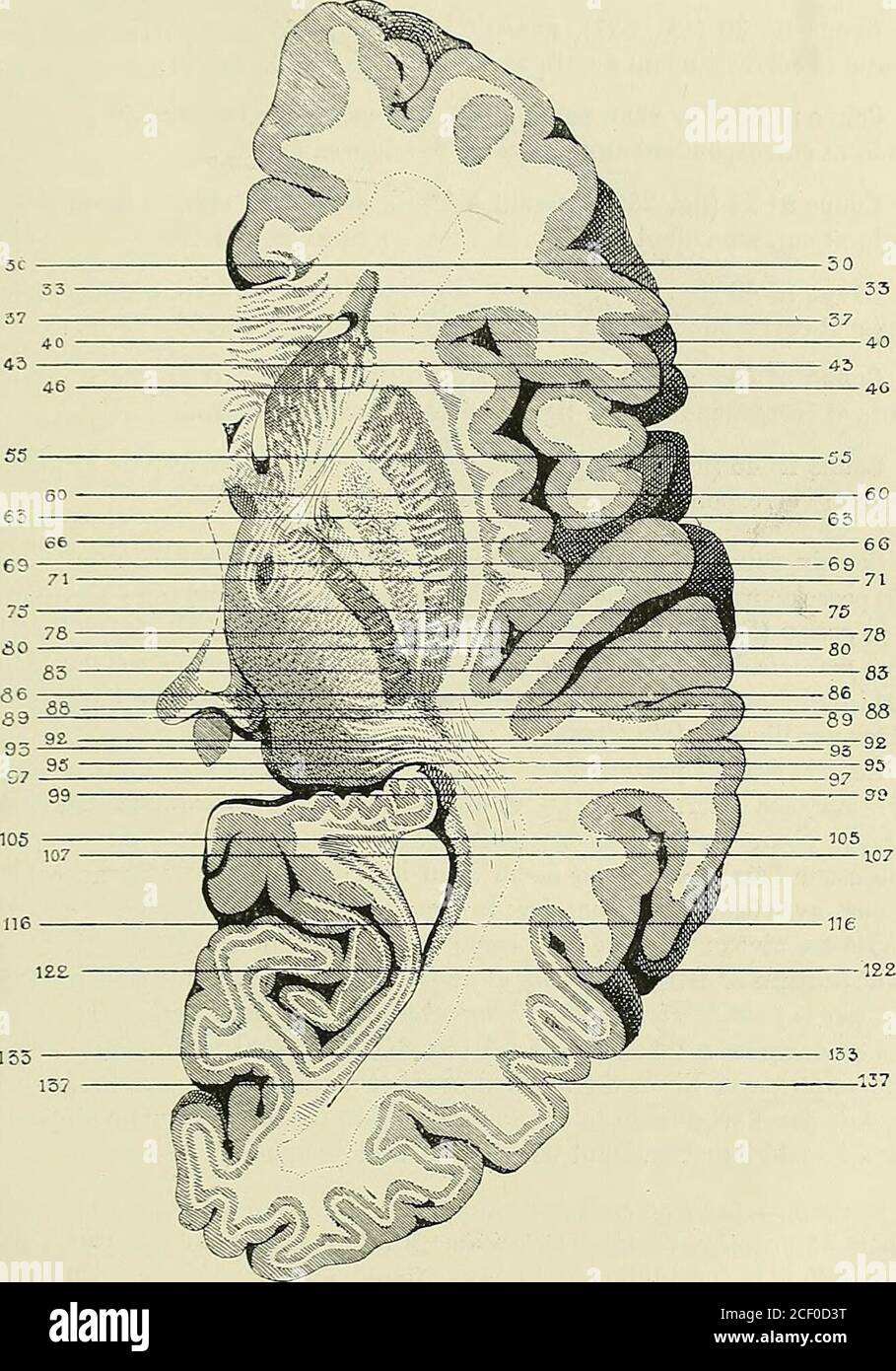 . Anatomie des centres nerveux. Fig. 235.— Face interne dun hémisphère droit durci dans les bichromates (3/4grandeurnaturelle) destinée au repérage des coupes vertico-transversales macroscopiques.Les lignes verticales correspondent aux numéros des coupes et indiquent, en mil-limètres, la distance à laquelle chaque coupe a été pratiquée en arrière du pôlefrontal. - du pôle frontal au pôle occipital, — et correspondant aux lignes derepère indiquées dans les figures 235 et 236. COUPES MACROSCOPIQUES DU CERVEAU. 433. 135 Fig. 236. — Coupe horizontale, passant par la région thalamique de la capsule Stock Photo