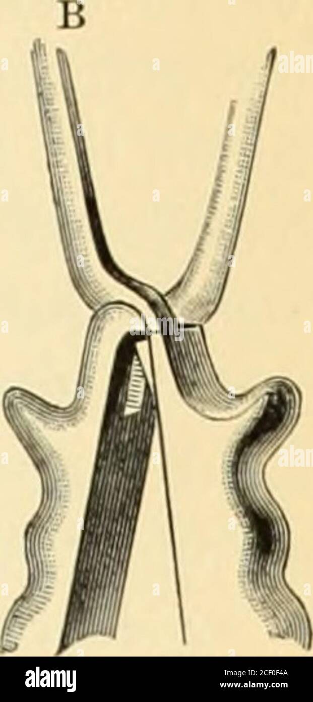 An American text-book of obstetrics. For practitioners and students. Fig.  487.—French (A) and English (B)locks. have a ring in the shank (Barness,  Fig. 471), or projecting shoulders (Simp-sons, Fig. 470) to