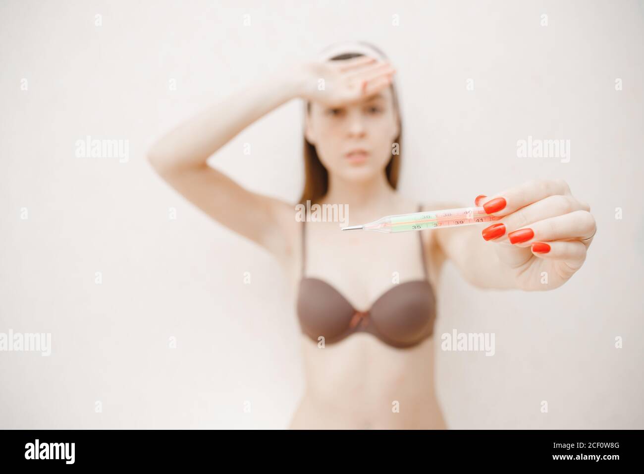Portrait young woman with chickenpox lying in bed and measuring temperature Stock Photo
