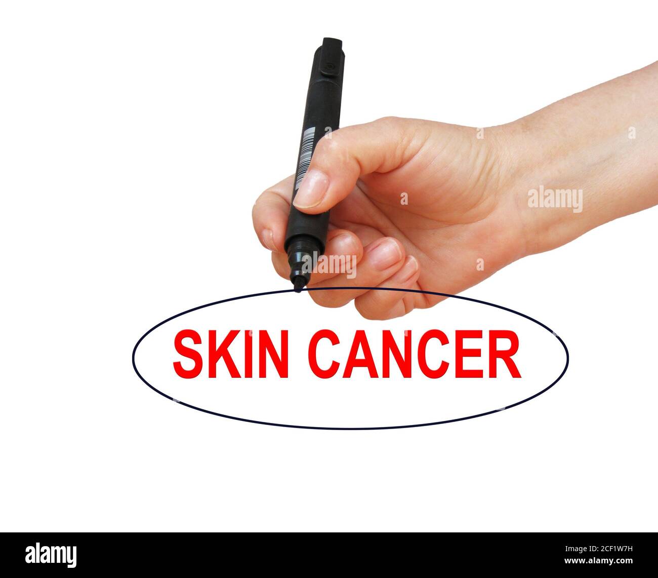 writing word SKIN CANCER with marker on white background made in 2d