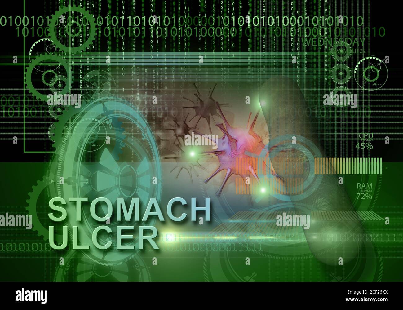 hi tech infographics of stomach ulcer made in 3d software. Stock Photo