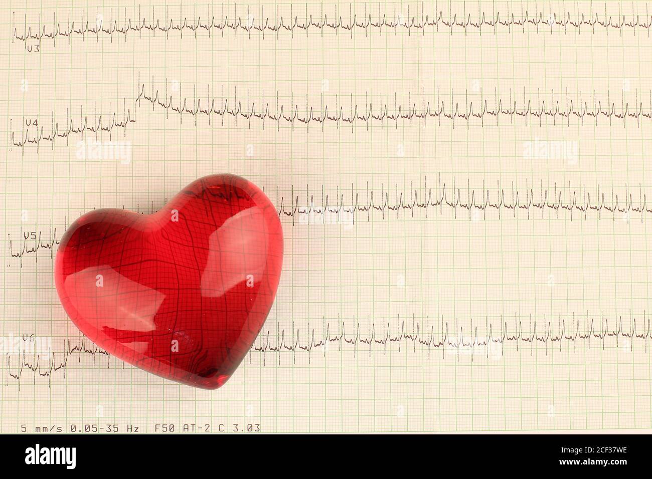Closeup shot of echocardiograph test report (ECG) Stock Photo