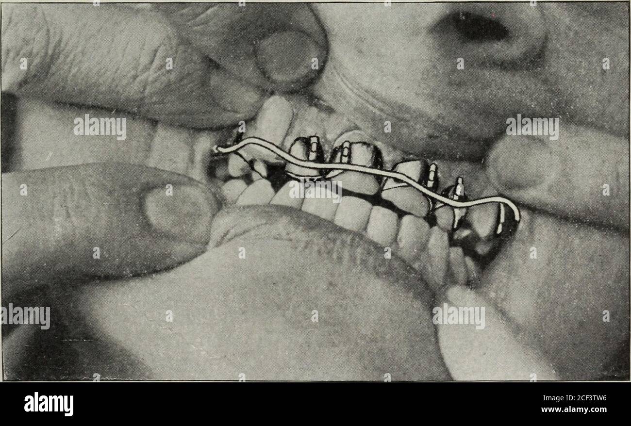 Conspicuous appearance hi-res stock photography and images - Alamy