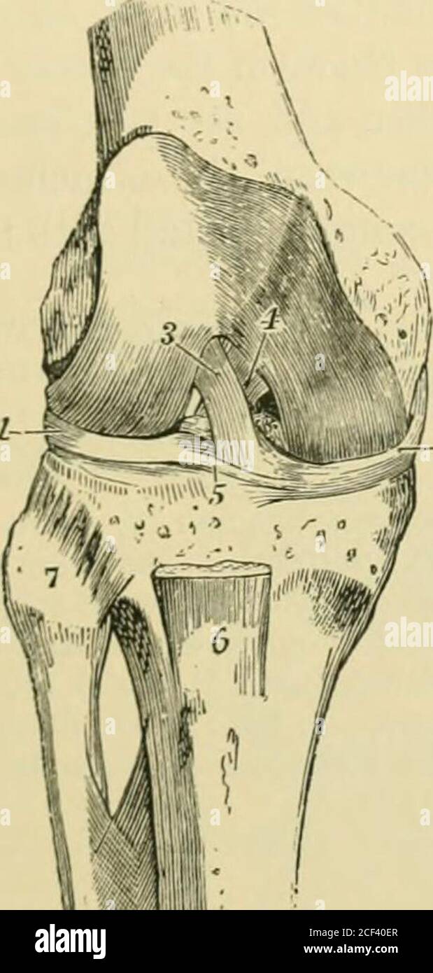 . Quain's Elements of anatomy. of the depression before thespine of the tibia, and by its upper extremity it is inserted into the inner and hinderpart of the external condyle of the femur ; hence its direction is upwards, back- THE KNEE-JOI^T. 185 ?wards, and outwards. The jjosterior or internal ligameni, stronger but shorter thauthe anterior, is attached below to the floor of the popliteal notch of the tibia, andabove to the lower part of the outer surface of the internal condyle, as well as to theadjacent fore part of the intercondylar fossa of the femur ; its fibres are directedupwards and Stock Photo