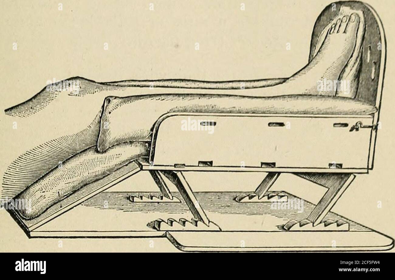 . A practical treatise on fractures and dislocations. Wire splint. The ...