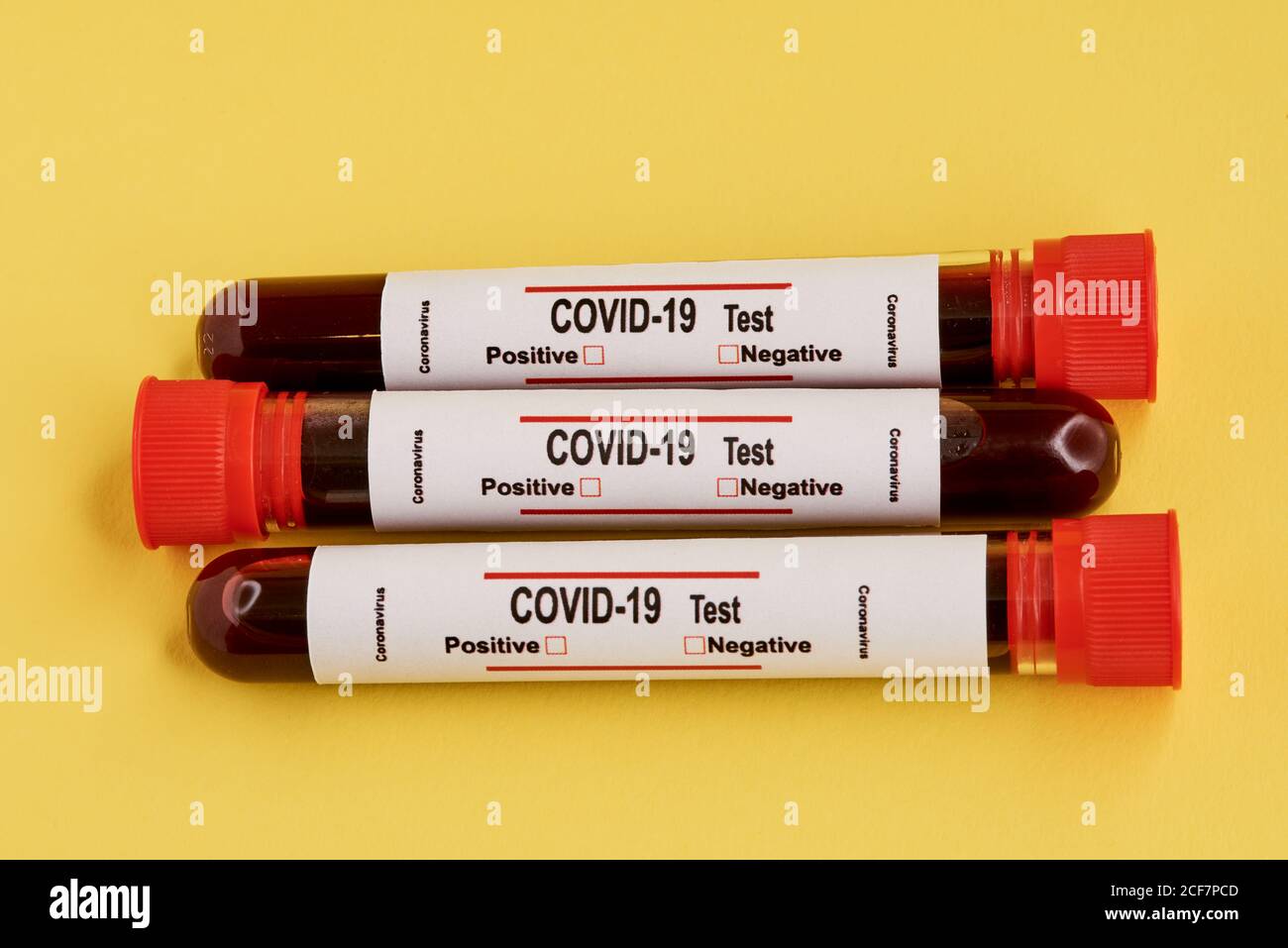 Yellow top blood tubes hires stock photography and images Alamy