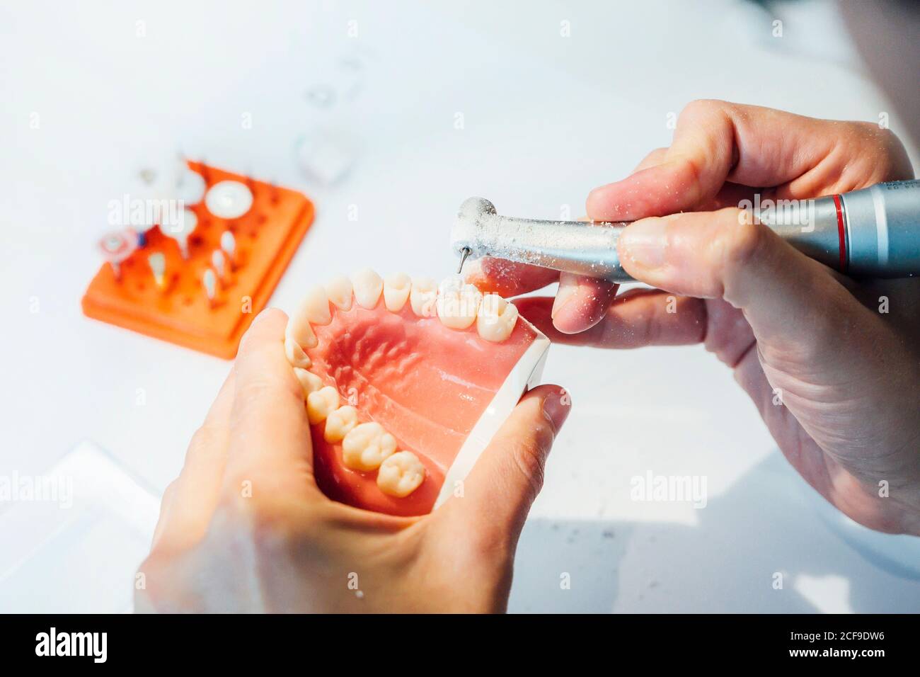 Dental study cast hires stock photography and images Alamy