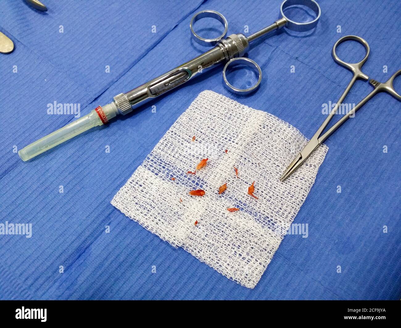From above of bloody pieces of fingernails on gauze and surgical instruments after operation in hospital Stock Photo