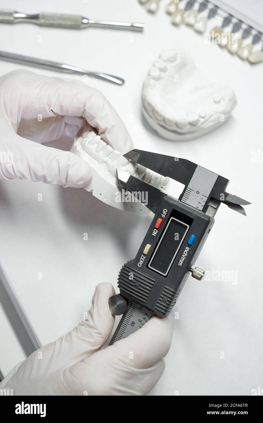 From above of crop anonymous orthodontist using caliper for measuring