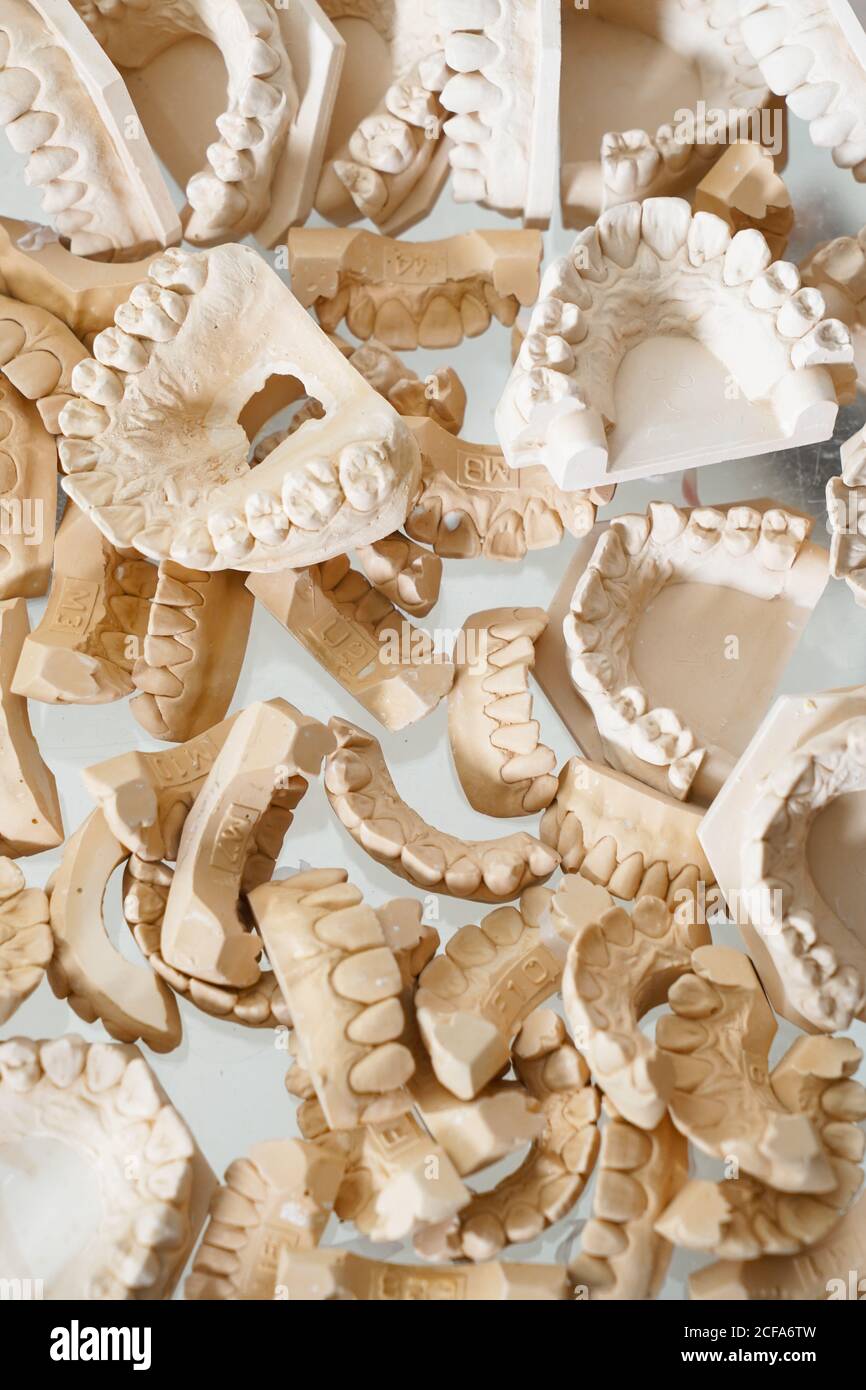 Top view of pile of various dental gypsum models of jaws in lab Stock