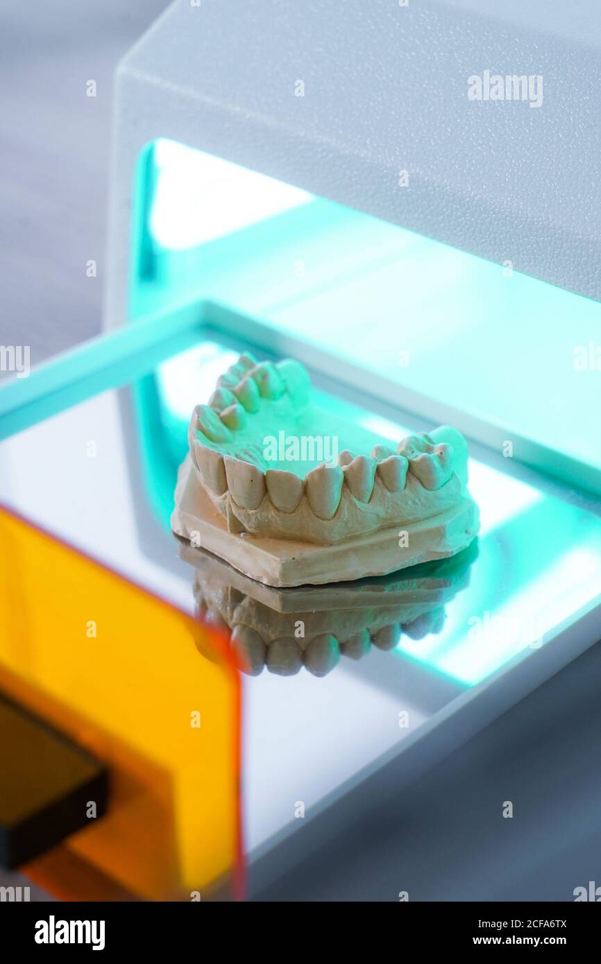 High angle of upper jaw dental cast model placed in light curing unit in modern laboratory Stock Photo