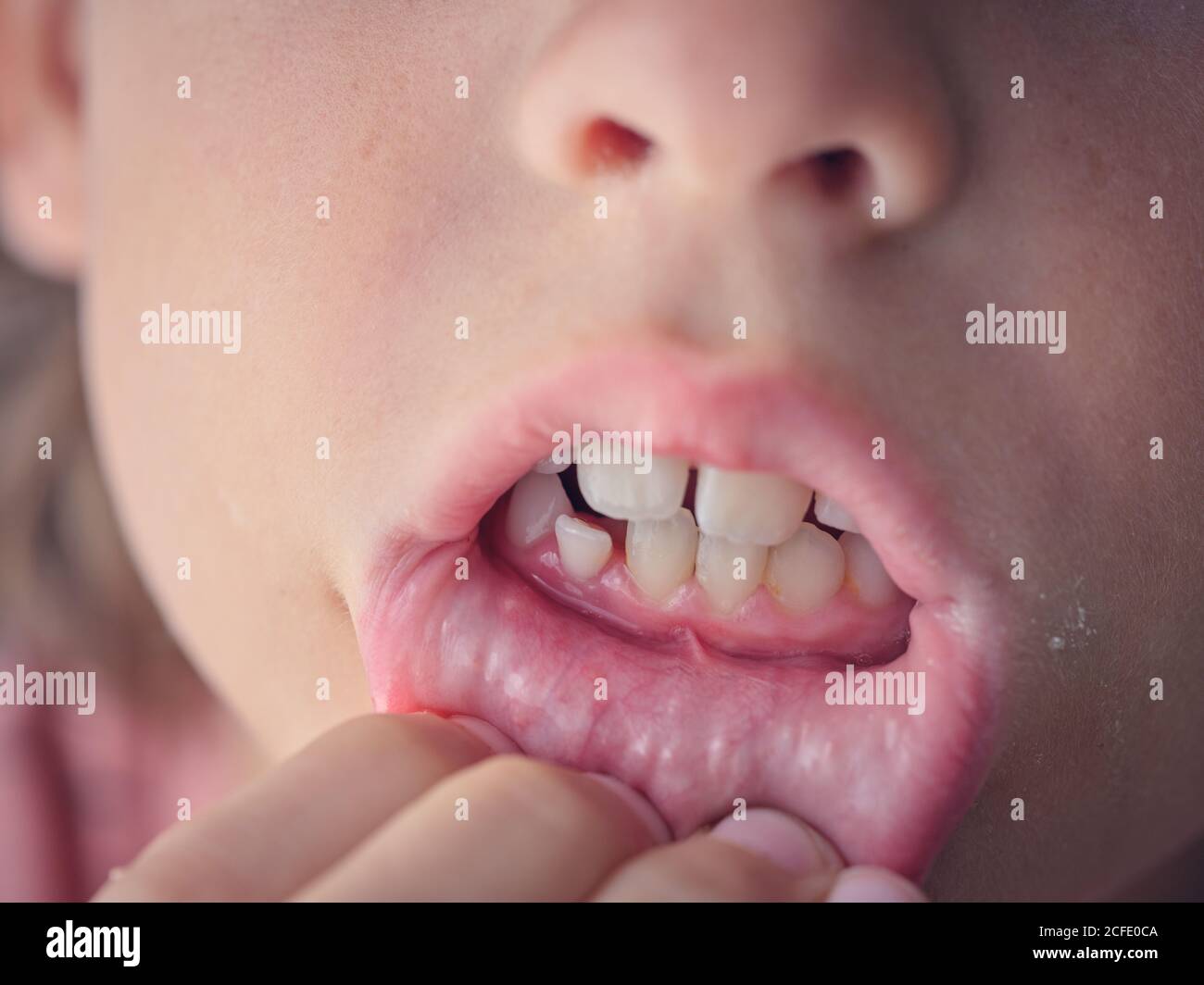 Lip pulling hi-res stock photography and images - Alamy