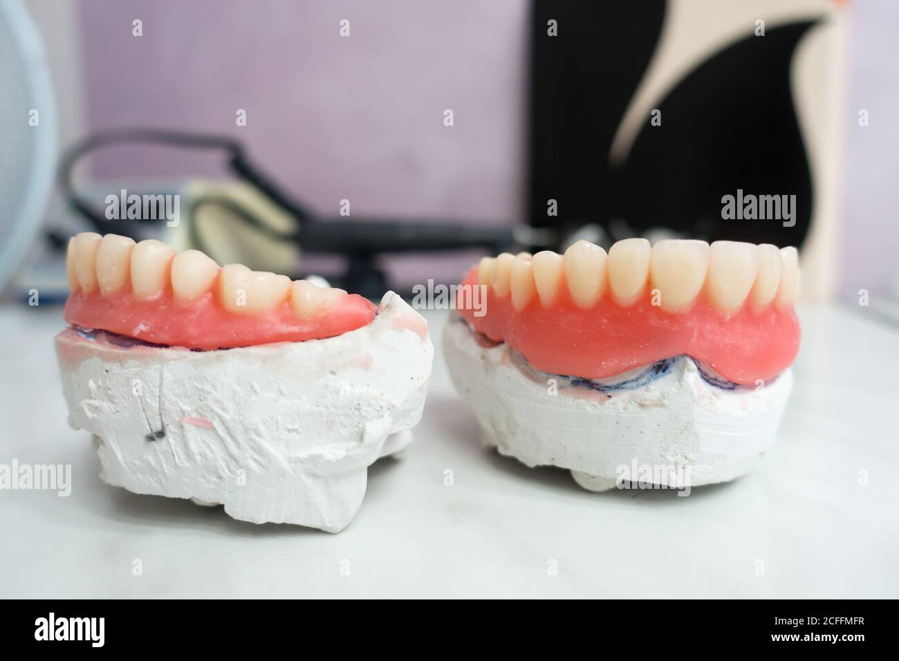 complete removable dental prostheses on gypsum models in the manufacturing process Stock Photo