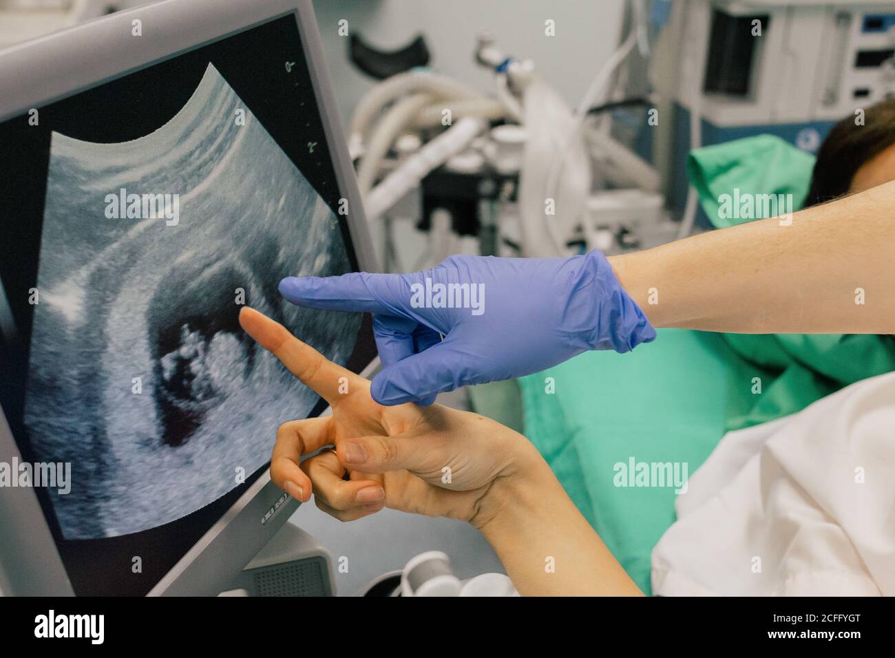 Crop unrecognizable doctor in blue glove pointing with indicate finger at computer screen while showing anonymous patient fetus during ultrasound test in clinic Stock Photo