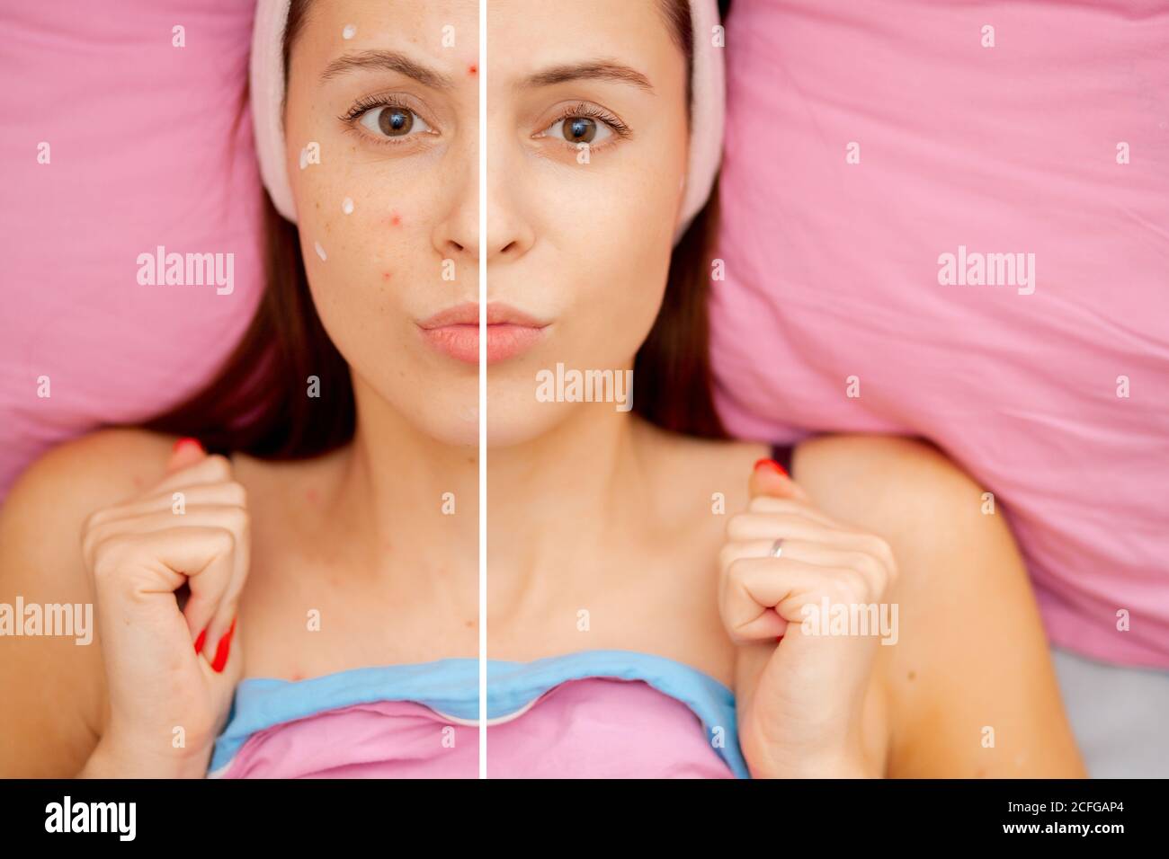 Skin Care Before Marriage Beauty & Health