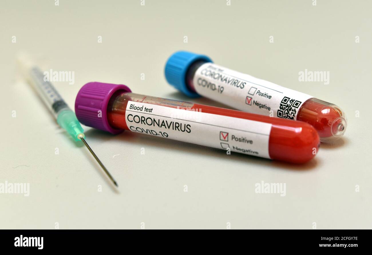 Coronavirus test blood sample positive result on white background. Coronavirus vaccine. Stock Photo
