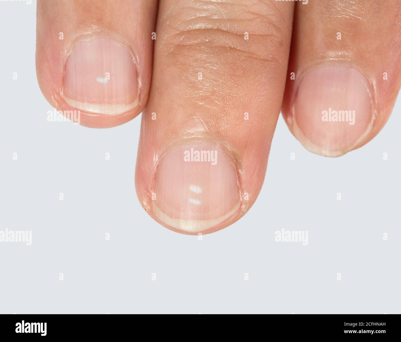 Why Does My Puppy Have White Spots On Her Nails