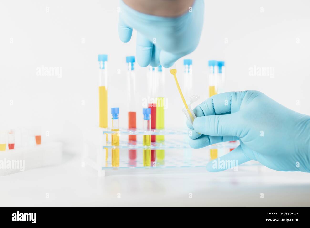Closeup of hands using a pipette and a plastic sample container with ...