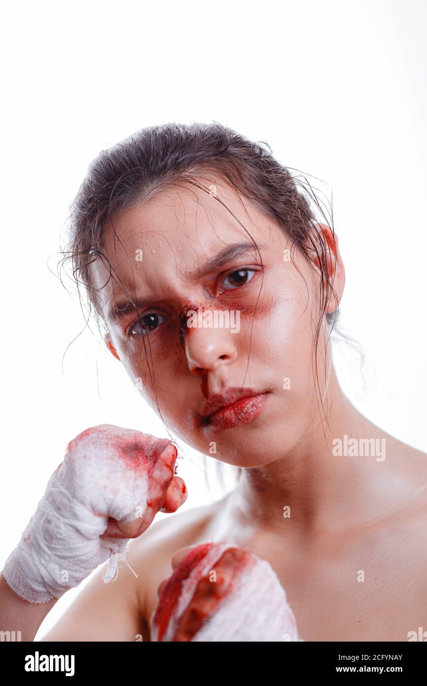 young woman with bruises on face victim of domestic violence. female