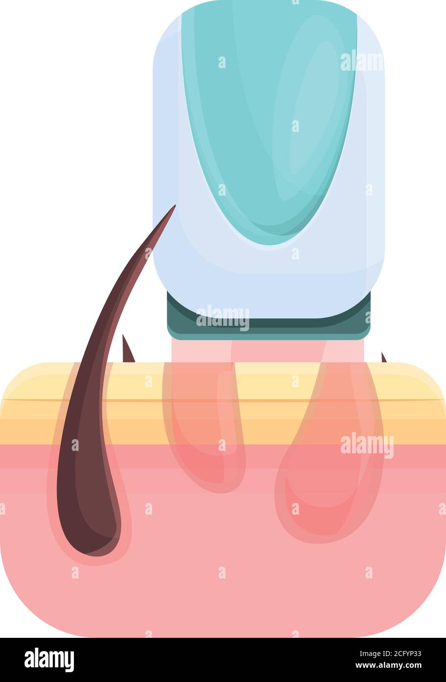 Laser hair removal process icon. Cartoon of laser hair removal process  vector icon for web design isolated on white background Stock Vector Image  & Art - Alamy