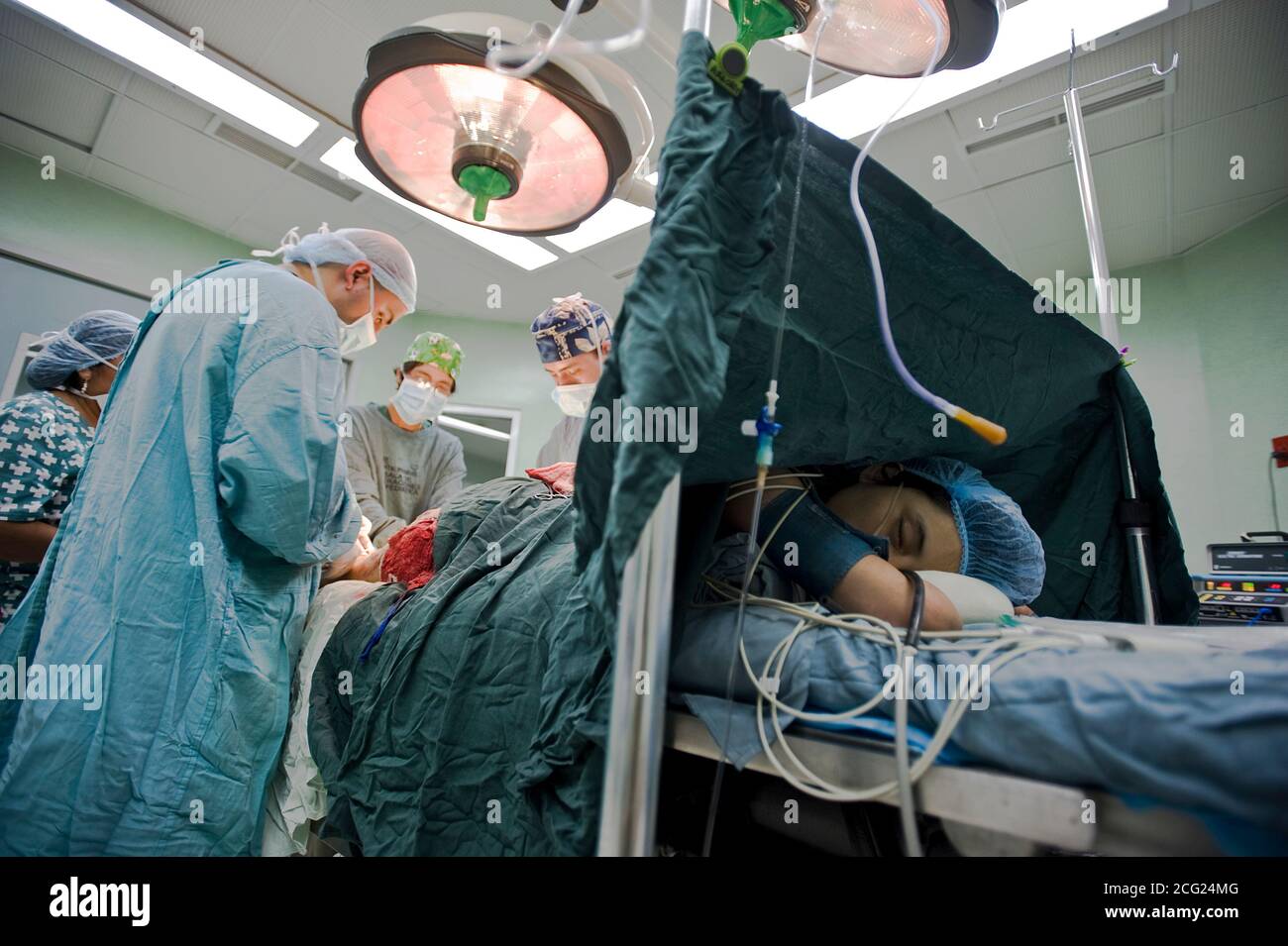 A skin graft surgery for ulcer on electrocuted patient in Roosevelt