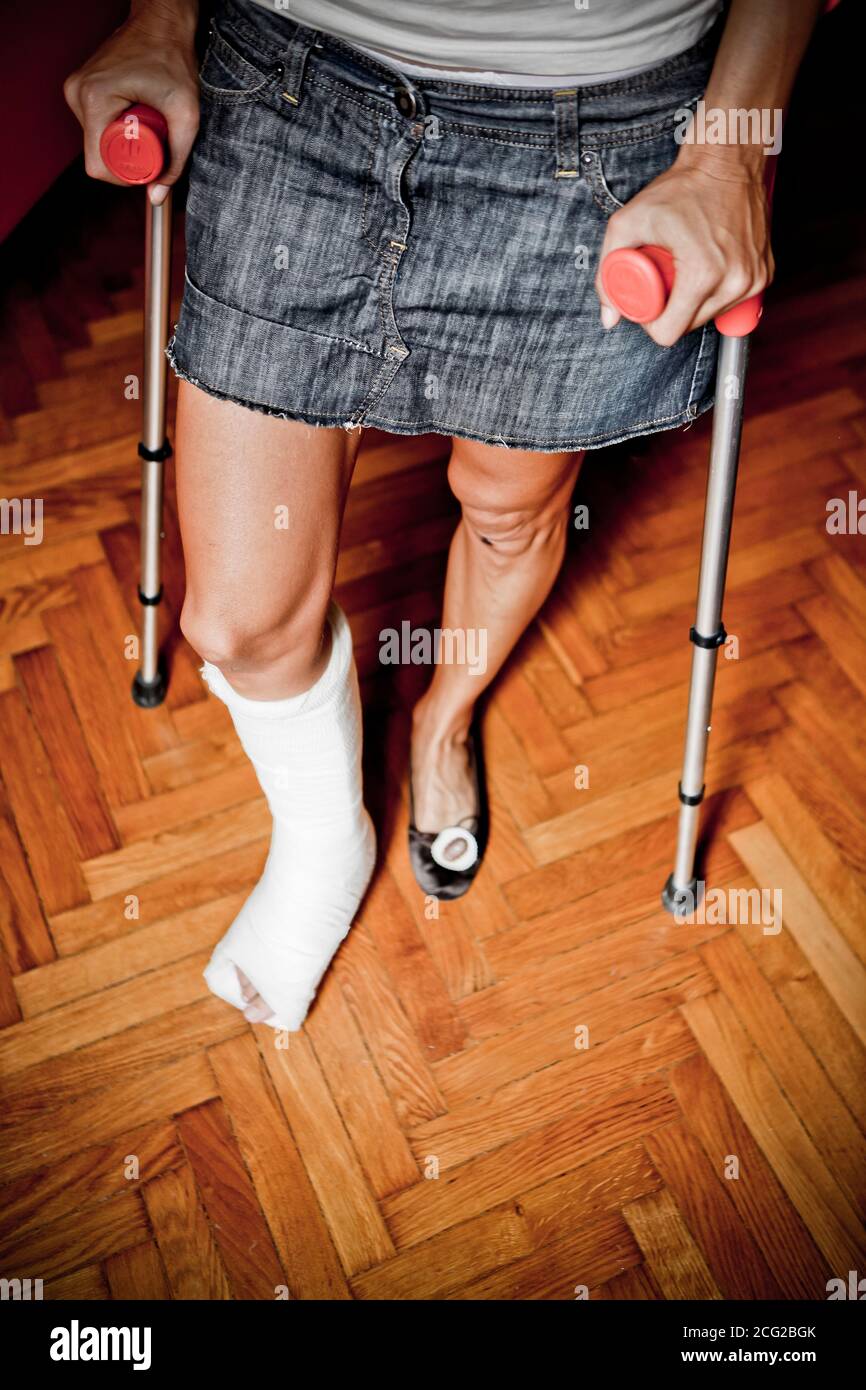 woman with one leg in plaster Stock Photo