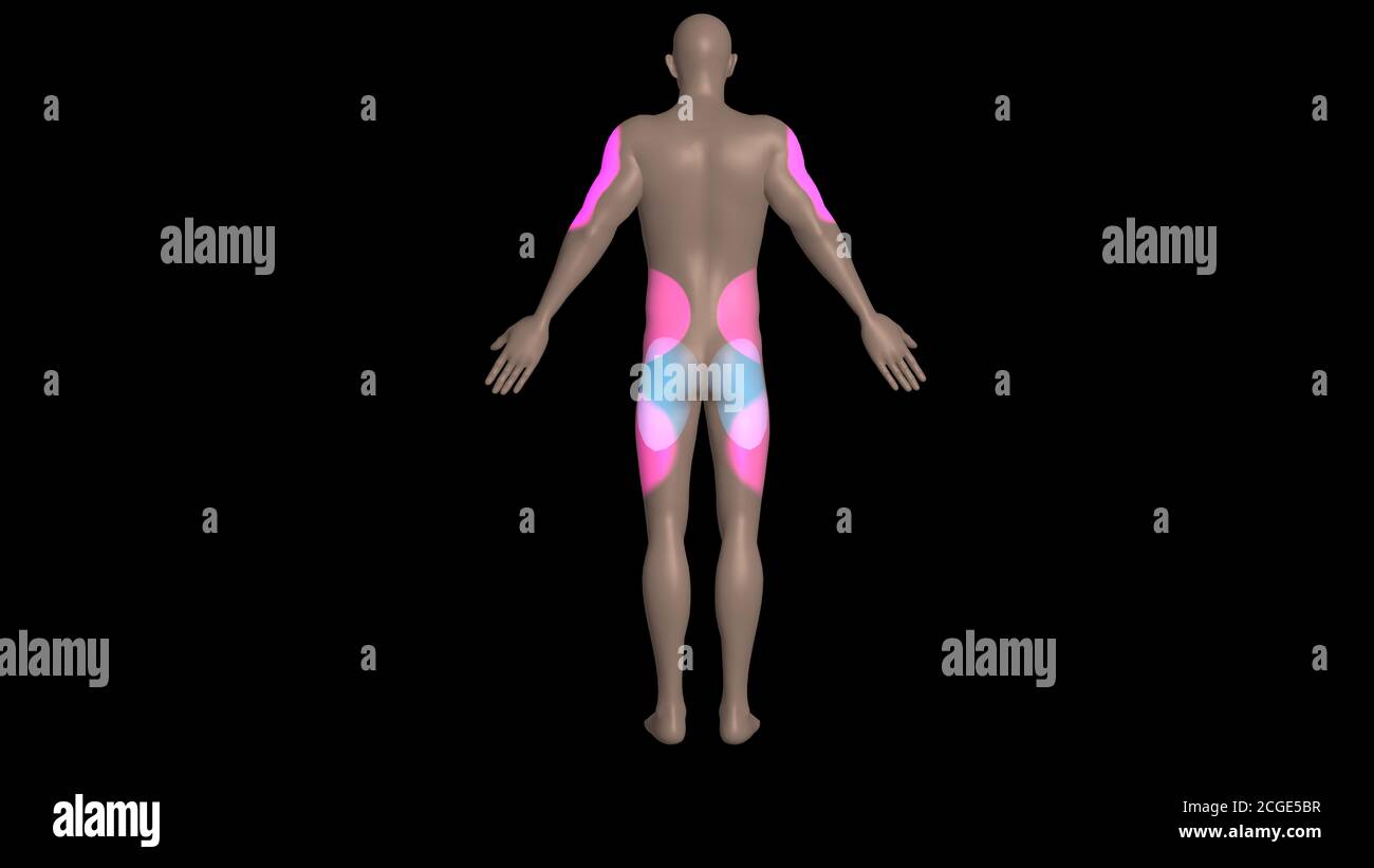 Injection sites on body.Common areas on body to inject drugs , vaccines ...