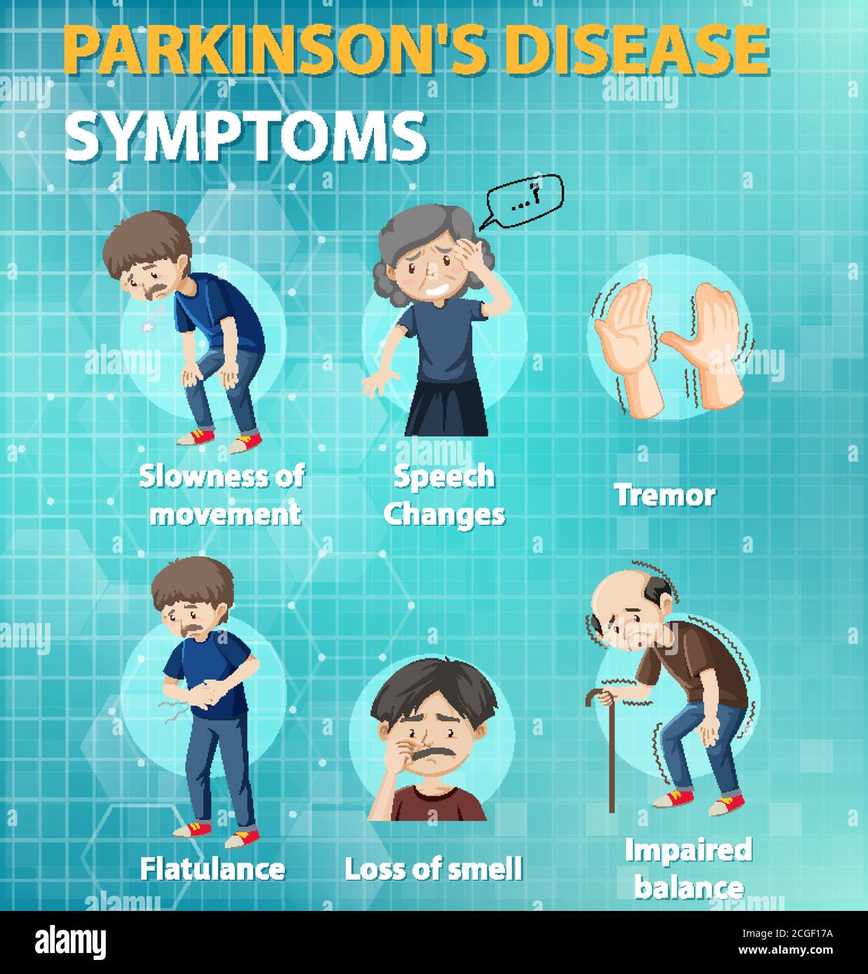 Parkinson disease symptoms infographic illustration Stock Vector Image ...