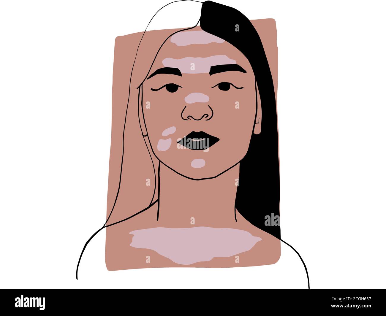 Hand Draw Outline Portrait Of A Young Woman With Vitiligo And Dark Beige Sample Color Abstract Colletion Of Different People And Skin Tones Divers Stock Photo Alamy Hand Draw Outline Portrait Of A Young Woman With Vitiligo And Dark Beige Sample Color Abstract Colletion Of Different People And Skin Tones Divers Stock Photo Alamy