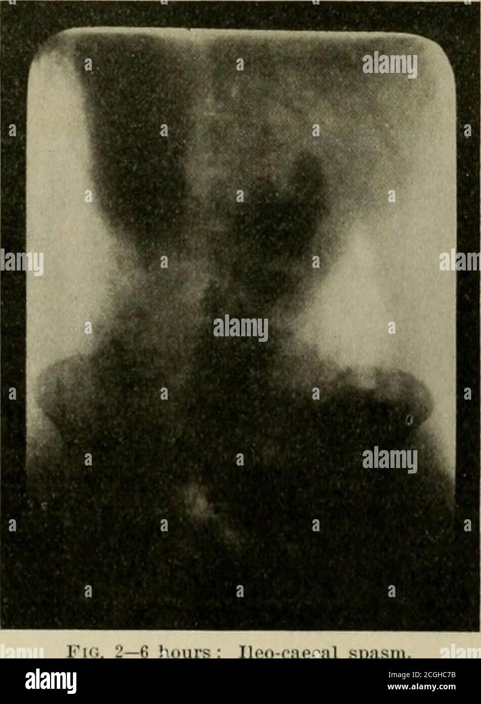 Testinal High Resolution Stock Photography And Images Alamy