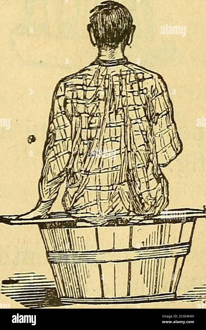 . Ma cure d'eau, ou, Hygiène et médication pour la guérison des maladies et la conservation de la santé . ut du corps ; puis mettezles pieds, découverts jusquau-dessus des genoux,dans un bassin en partie rempli deau, prenez avecnimporte quoi de cette eau du bassin et répandez-la lentement sur les genoux et les jambes. Mêmedans le cas où lopération se fait de cette manièresimple et primitive, leffet se fera certainementsentir. 3. Affusion dorsale. Laffusion dorsale est la continuation de laffusionsupérieure. On lemploie quand il sagit de fortifierspécialement léchiné. Elle favorise également tr Stock Photo