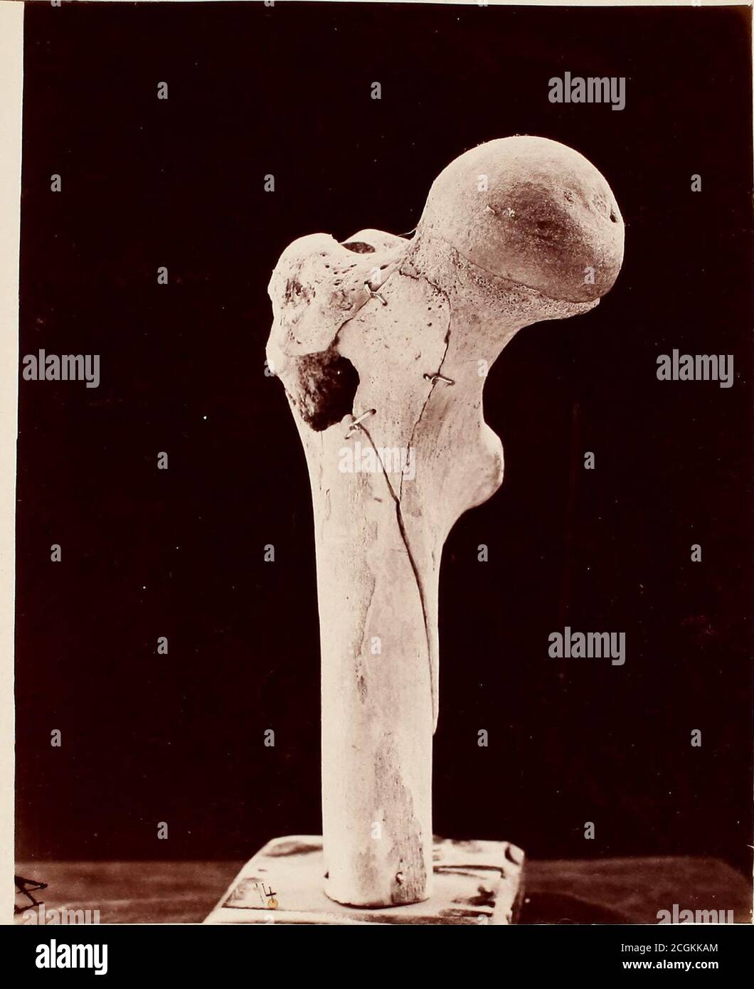 Photographs Of Surgical Cases And Specimens Trepared U7ider T Ie Siepervisio7i Of 4ssistant Urgeon Peorge A Pris P S A By Order Op The Surgeon General R V J Yj Rgeon Fjenerals