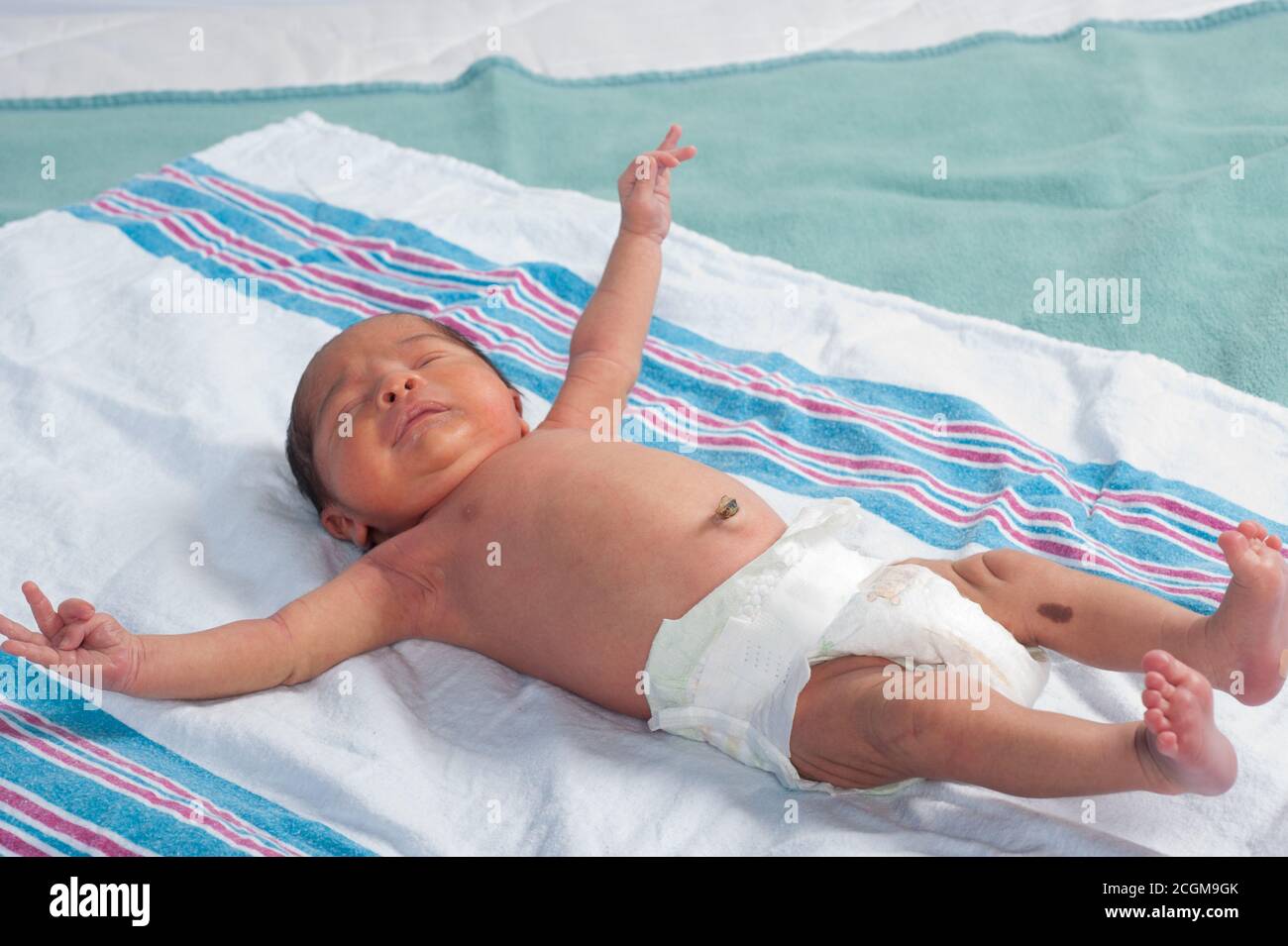 Moro reflex hires stock photography and images Alamy