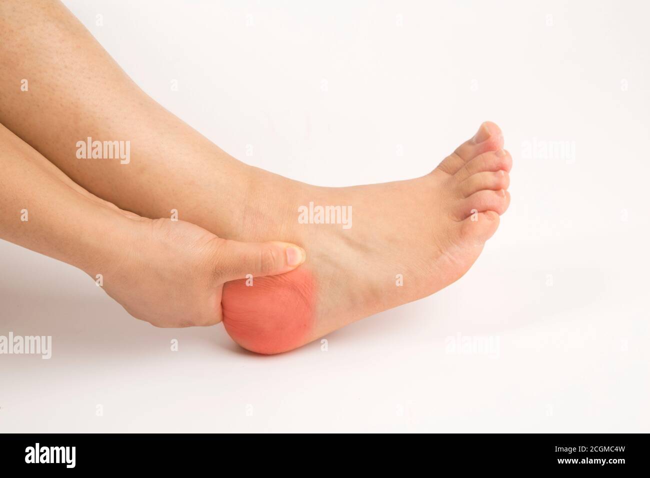 foot heel pain woman and isolated background Stock Photo