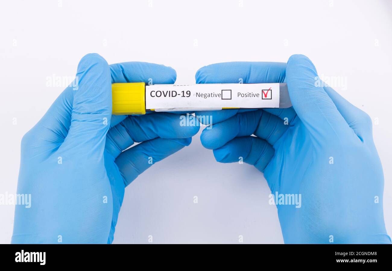 coronovirus, 2019 N-cov, epidemic disease, blood tubes Stock Photo