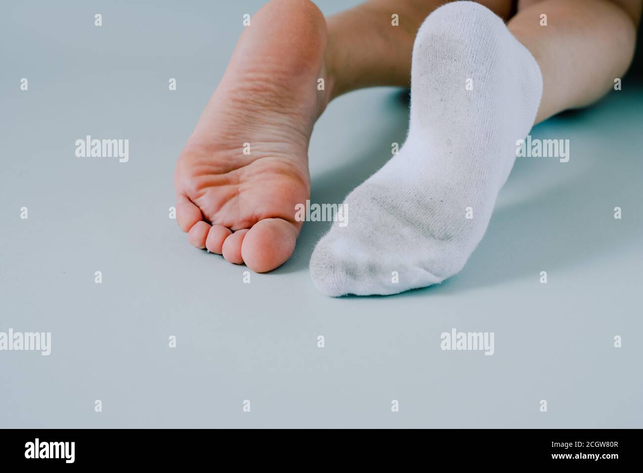right foot in dirty sock, left foot without socks.Isolated on gray background Stock Photo