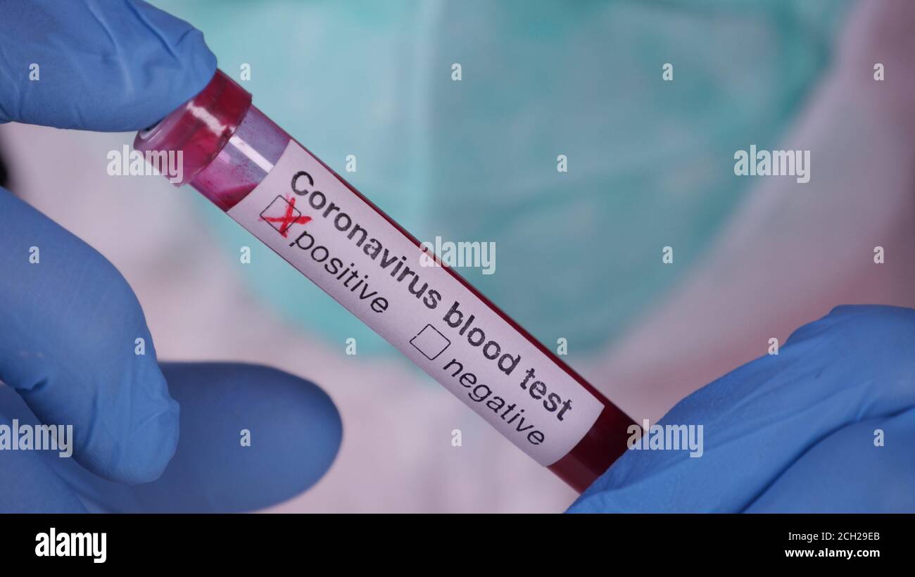 Safety test hi-res stock photography and images - Alamy
