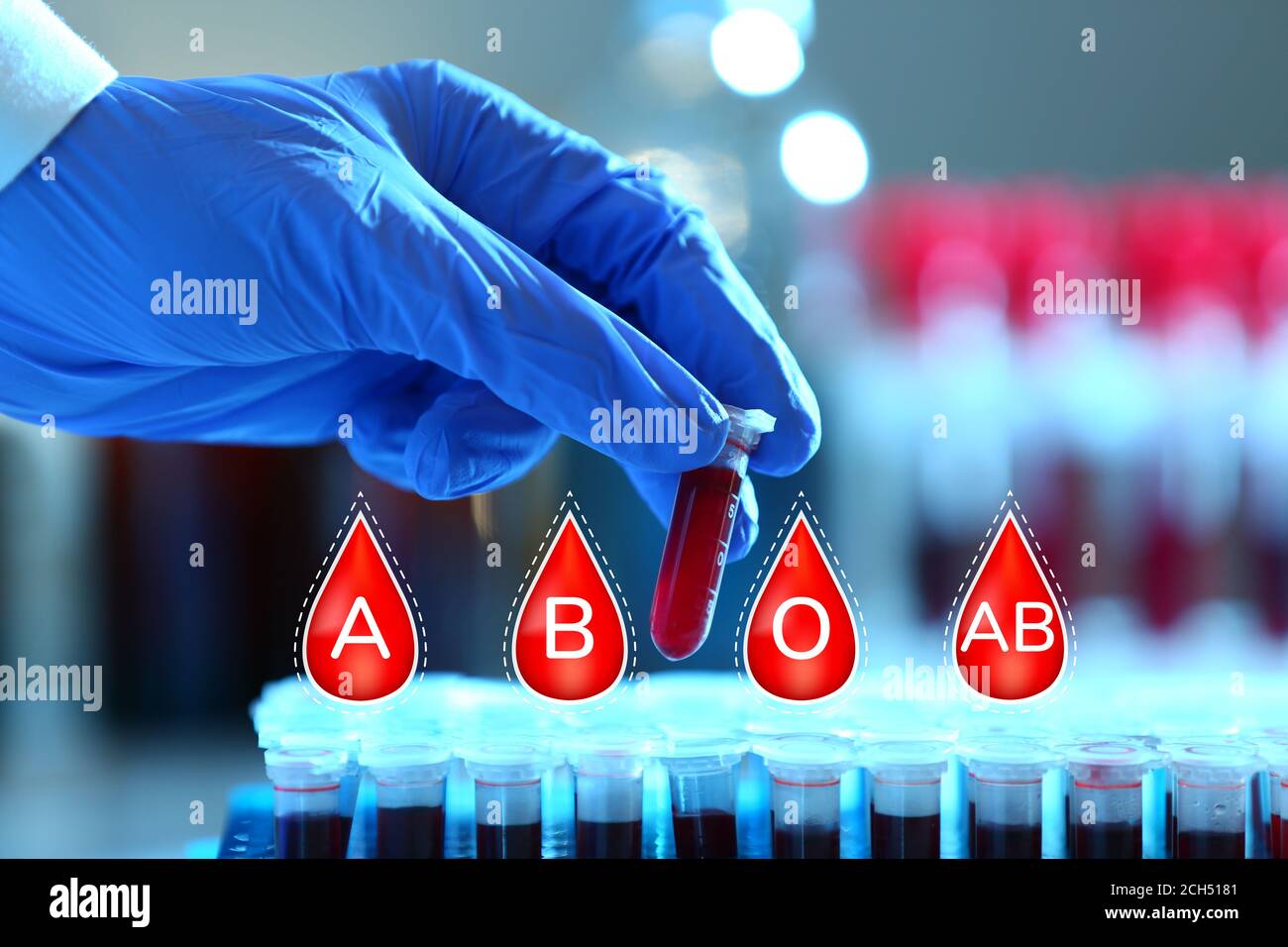 Abo blood type testing hi-res stock photography and images - Alamy