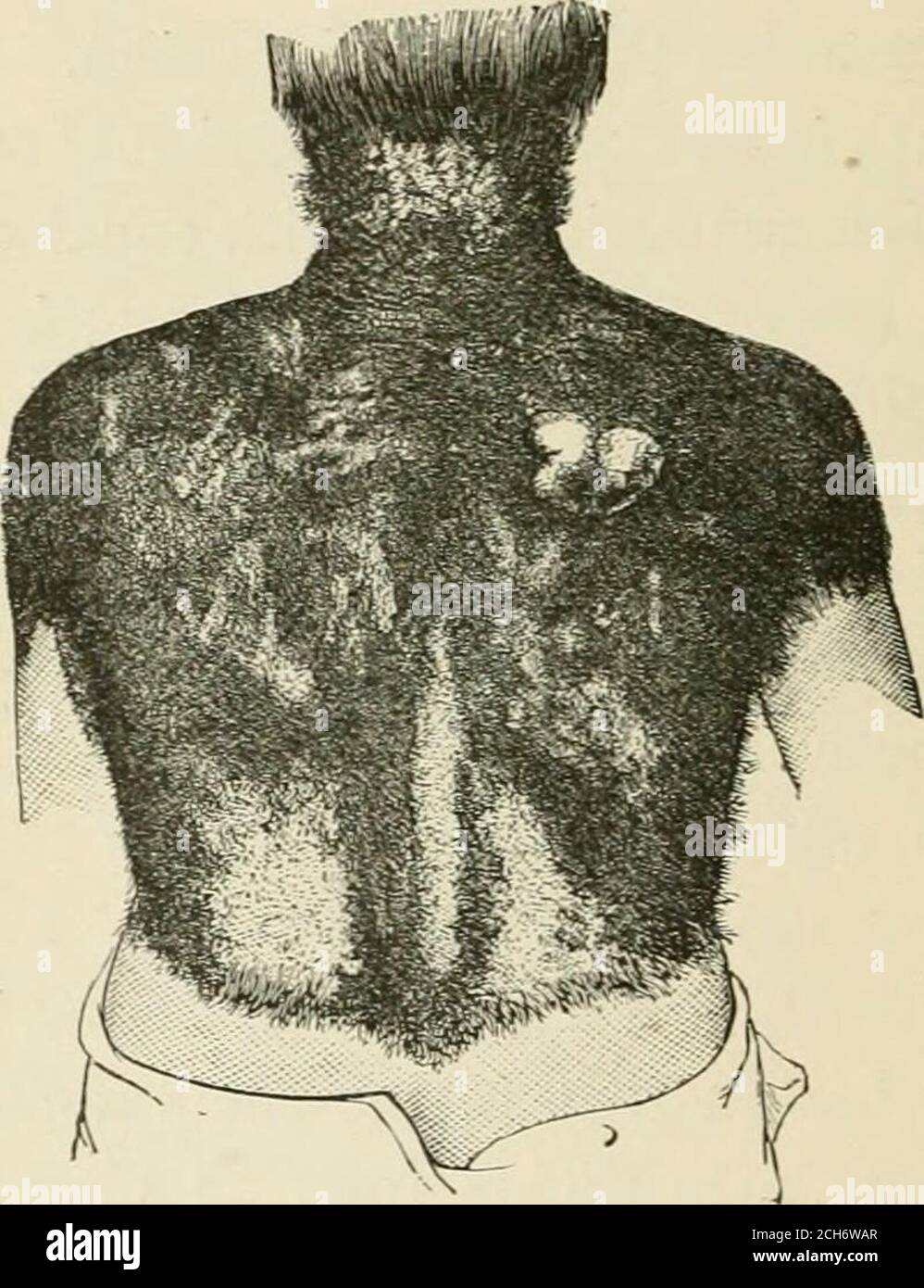 . Evolution and disease . atavism. It is well known that in the small ...