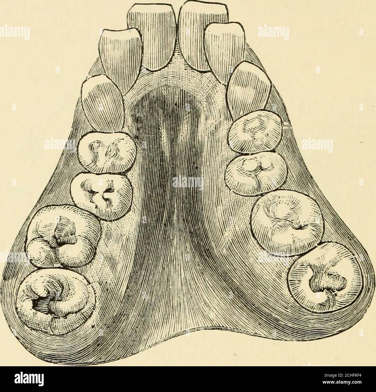 . The teeth in health and disease . Fin. 15.—An irregularity caused by ...
