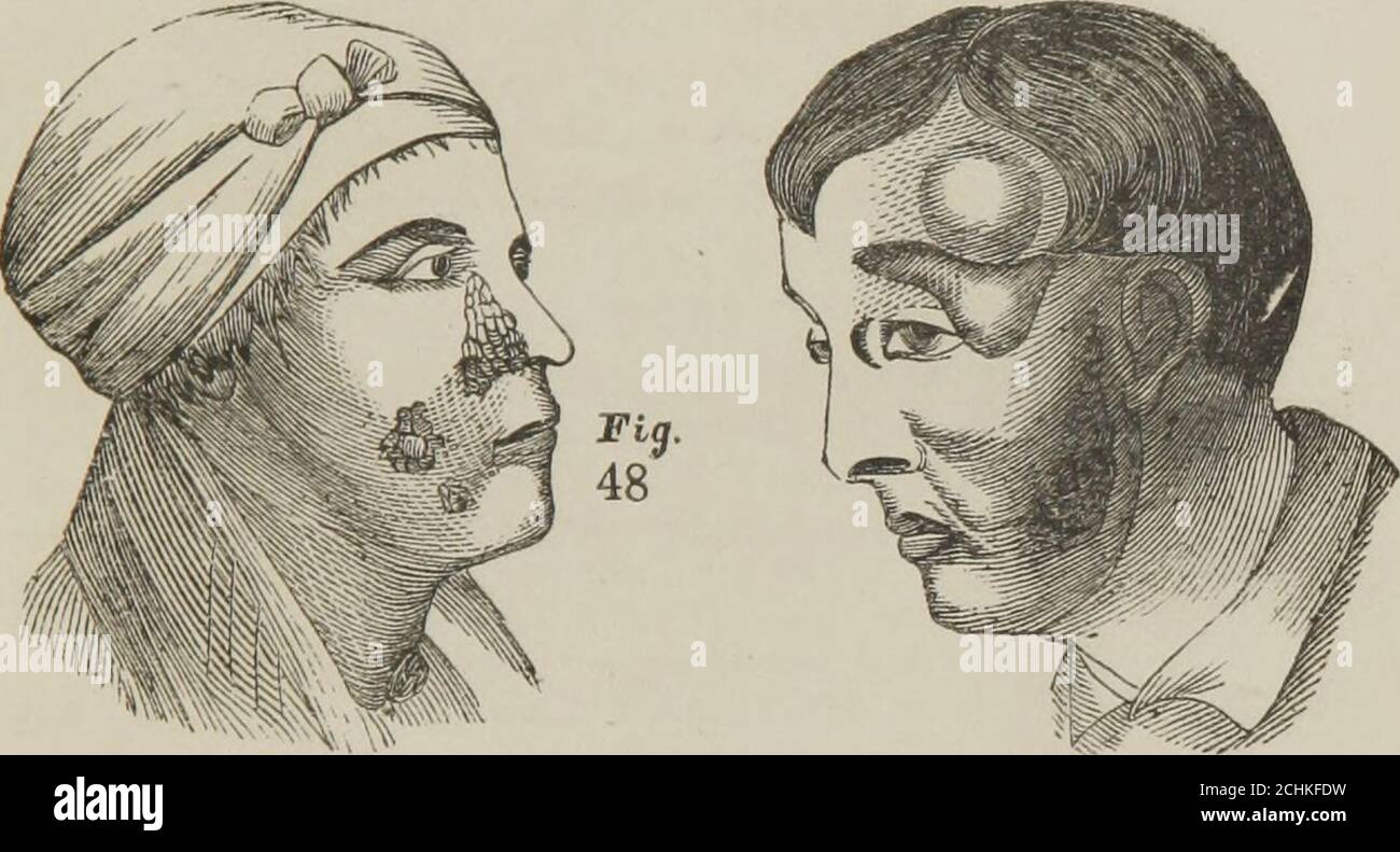 Deformed Male Genitals Deformed Male Genitals
