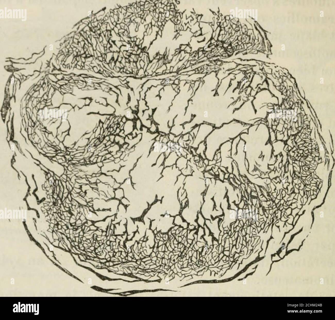 Jui cer hires stock photography and images Alamy