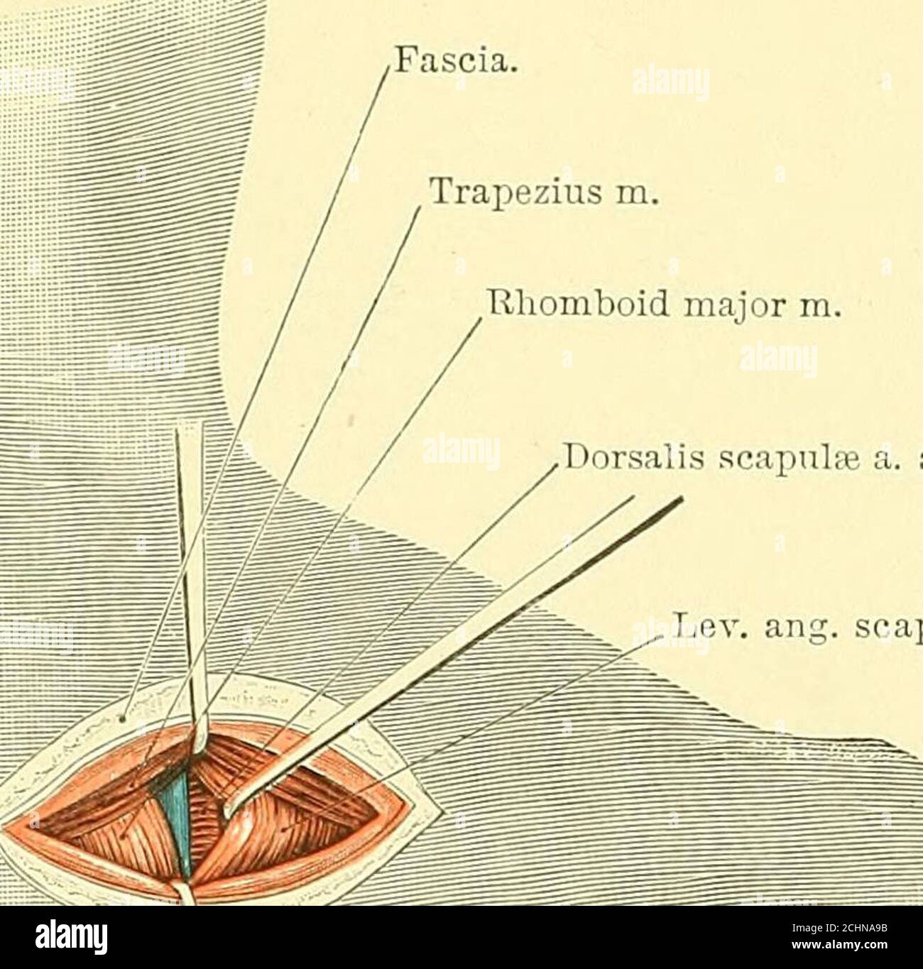Text Book Of Operative Surgery Fascia Trapezius M Rliomboid Major M Dorsalis Scapulai A Aiid V Lev Ang Scap Lu Fig 38 Ligature Of Snprascapular Artery At The Superior Angle Of
