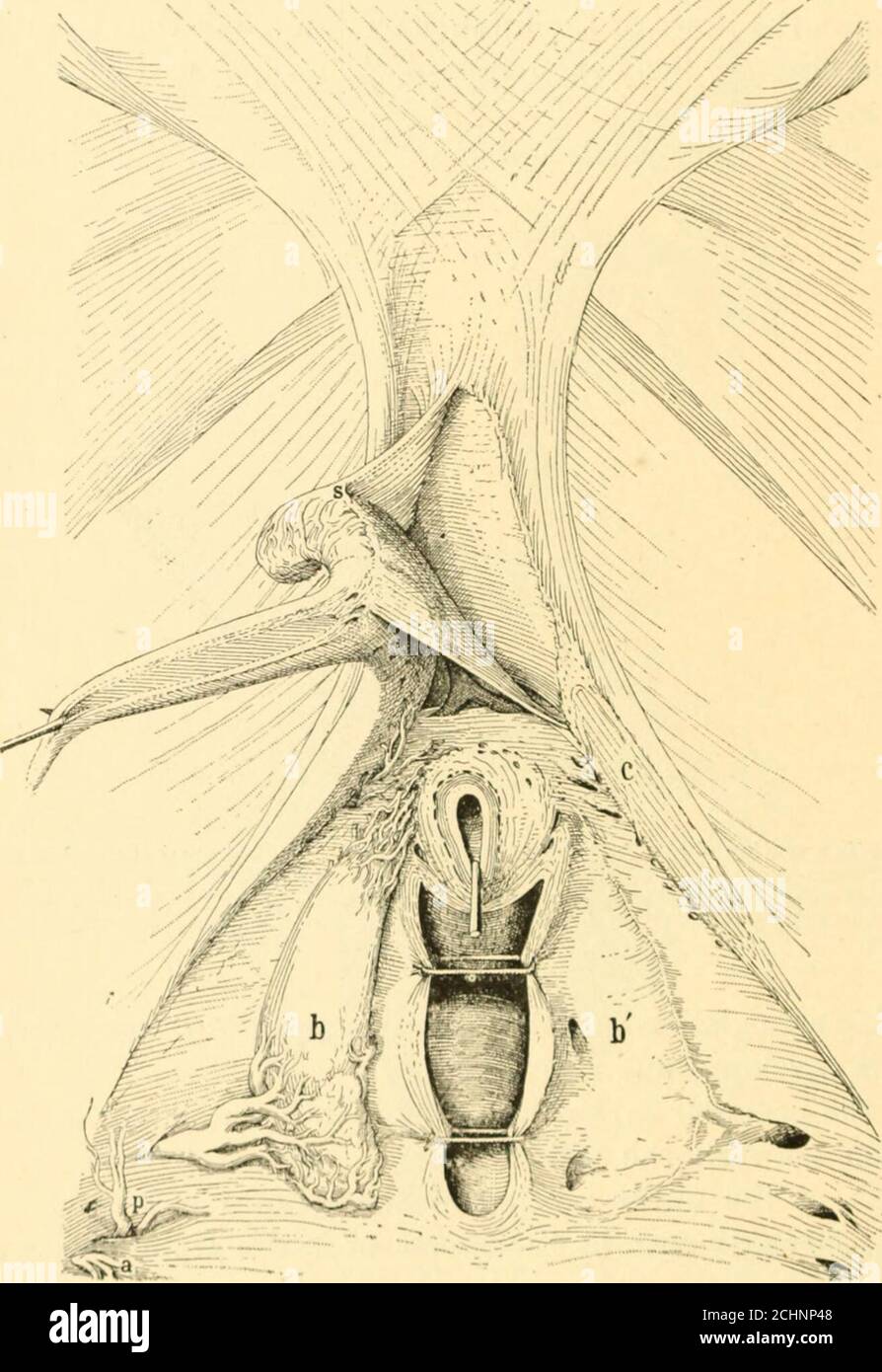 . The science and art of midwifery . ccess of fibers from distant sources,as, for instance, from those which border the pubic crests. Below,beneath the pubic arch, it forms the ligamentum arcuatum. Ante-riorly the symphysis is increased in thickness by the accession of a vastnumber of tendinous elements which intercross at the median line. When an incision is made through the adipose tissue of the monsveneris, and the divided surfaces are drawn well apart, the operatorexposes laterally the attachments of the muscles of the thigh to thebony ridges which border the symphyseal space. Overlying th Stock Photo