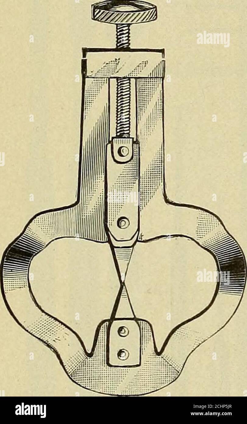 . Operative and dental anatomy technics; a class-room and laboratory manual for freshmen dental students . leaners. (Barbed broaches.) I ^ I A B C D 6 78 Fig. ioi.—Kerr twist or spiral broaches. No. i is enlarged. B is a nub-broach. Nos. 6, 7, 8, are for the engine hand-piece. Fig. 102.—]Ictal broach-holder. and easily broken. For canal work the temper should usuallybe drawn, as already described. (2) Hooked hroaeh—hookedextractor—a smooth broach with a hook on the end, eitherat a right or acute angle, used for removing pulps and for 76 INSTRUMENTS AND APPLIANCES measuring the length of canal Stock Photo