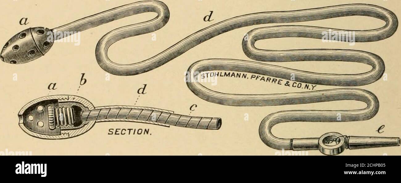 . Diseases of the stomach : including dietetic and medicinal treatment . re frequently thanat the present time. The writers introgastric electrode consists of aperforated hard-rubber capsule containing a metallic tip to which is 330 ATONY OF THE STOMACH attached a spiral of fine ])iano wire covered with rubber tubing, so as tobe both small in caliber and extremely flexible. The electrode is easilyintroduced and creates after one or two introductions little or nodiscomfort. A large moist pad is then placed over the epigastriumand a slowly interrupted faradic current passed, of sufficient intens Stock Photo