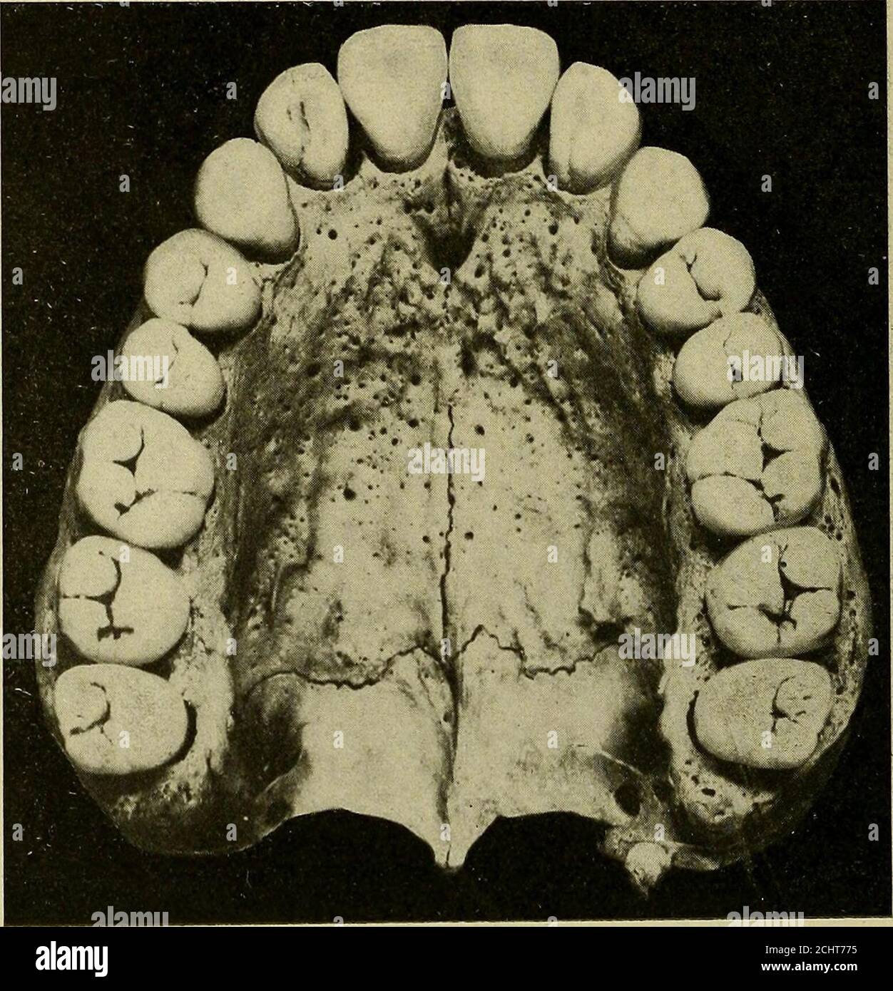 . Operative and dental anatomy technics; a classroom and laboratory